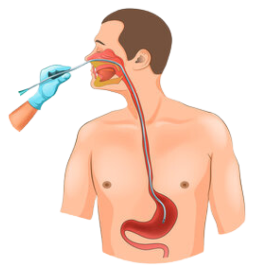 Ryle's Tube Change At Home