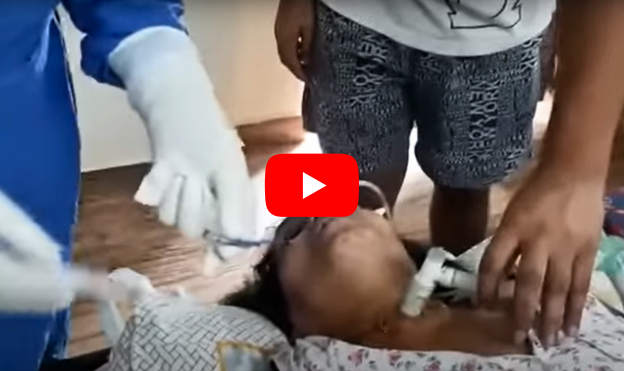 Tracheostomy tube change at home | Best Nursing Staff Services at Home | Care Oxy