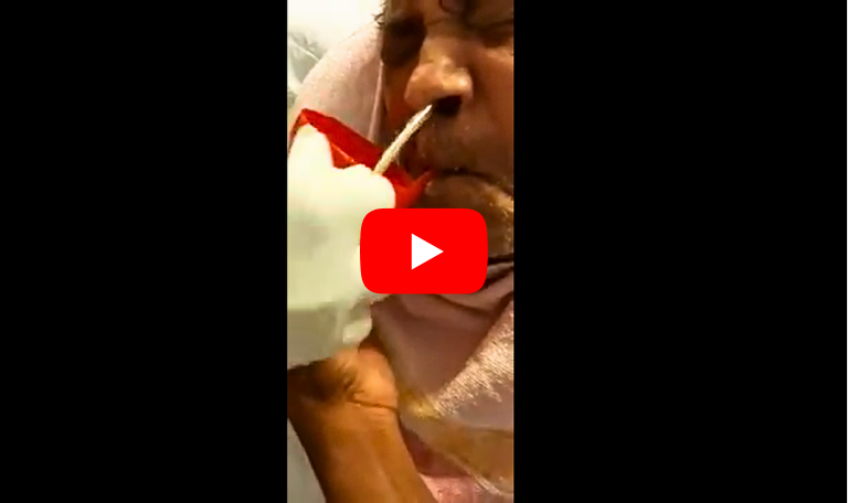 Ryles tube insertion at home | Best Home Attendant/Nursing Staff Services | Care Oxy